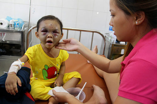 Hậu quả của hành vi bạo hành trẻ em và biện pháp phòng tránh